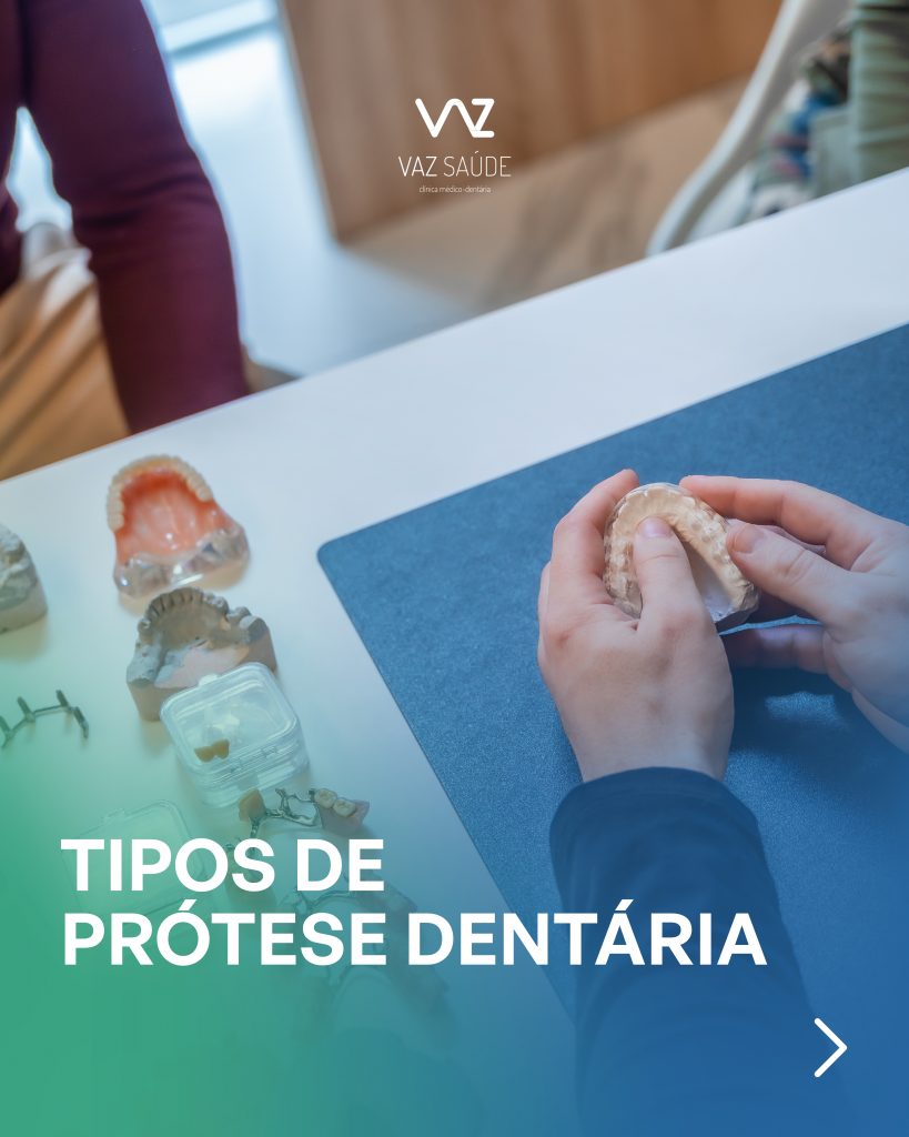 Tipos de Prótese Dentária: Qual a Melhor Solução para Si?